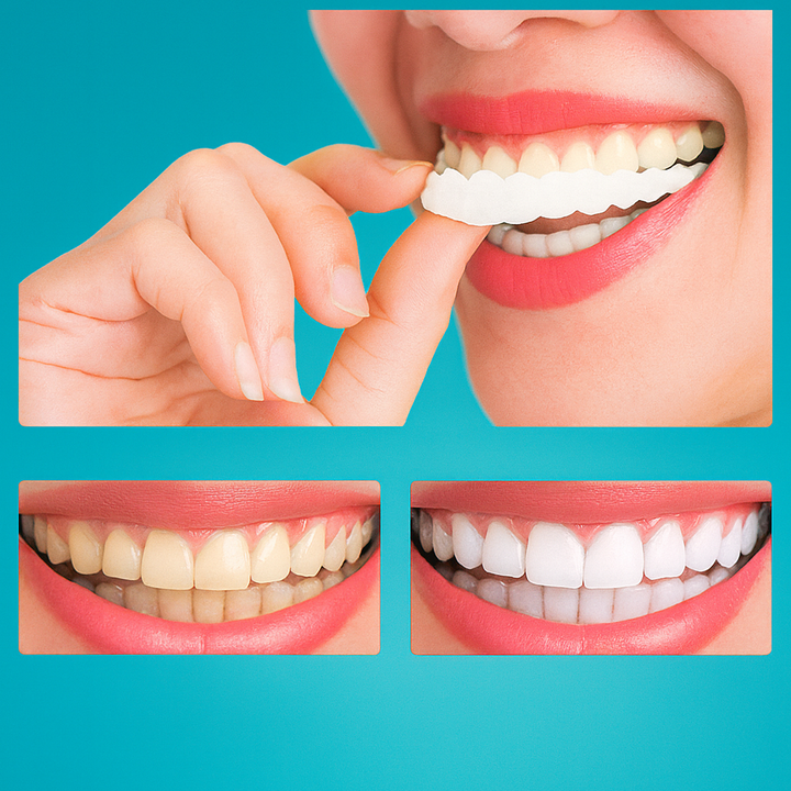 CARILLAS DENTALES